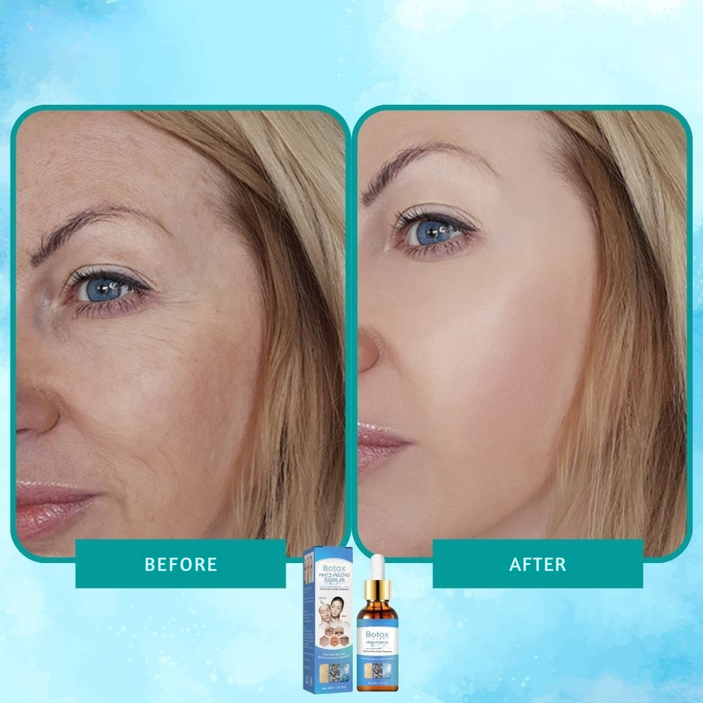 Intenzív ránctalanító Botox szérum elixír 